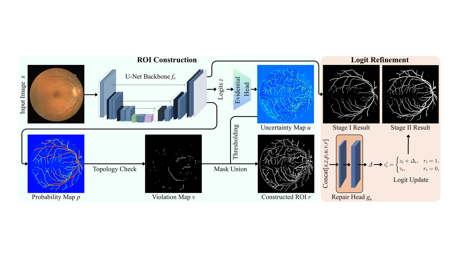 Post-hoc Budgeted Uncertainty-Guided Topology Repair for Retinal Vessel Segmentation figure